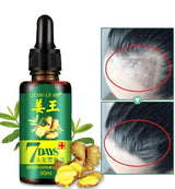7 Days Ginger Germinal Oil - Hair Regrowth Serum 30ml