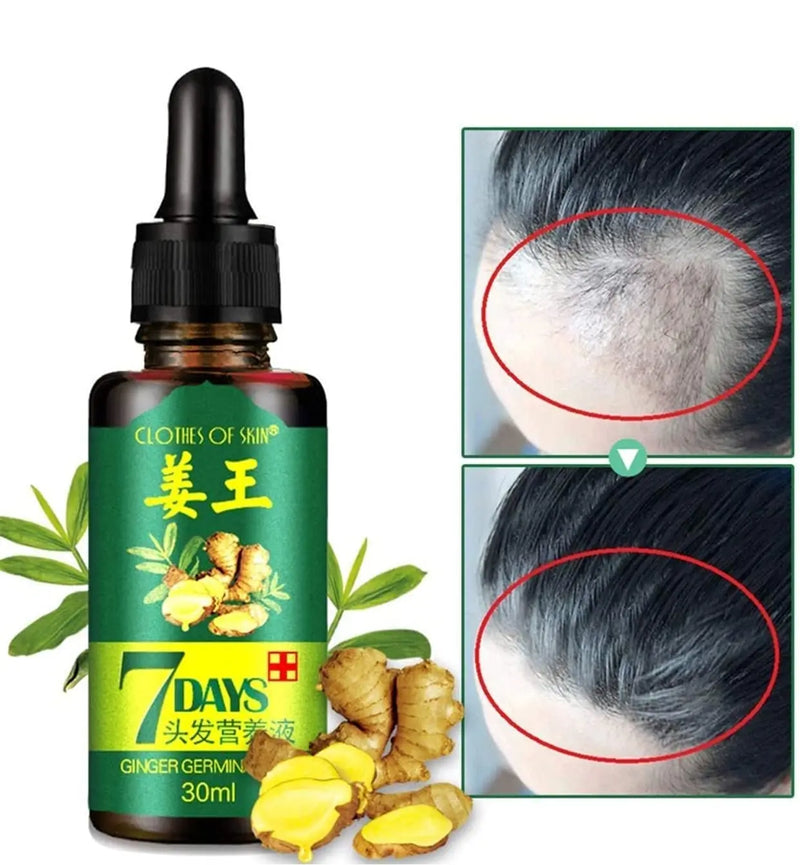 7 Days Ginger Germinal Oil - Hair Regrowth Serum 30ml