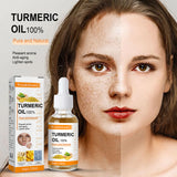Turmeric Serum Remove Dark Spots Essential Oil
